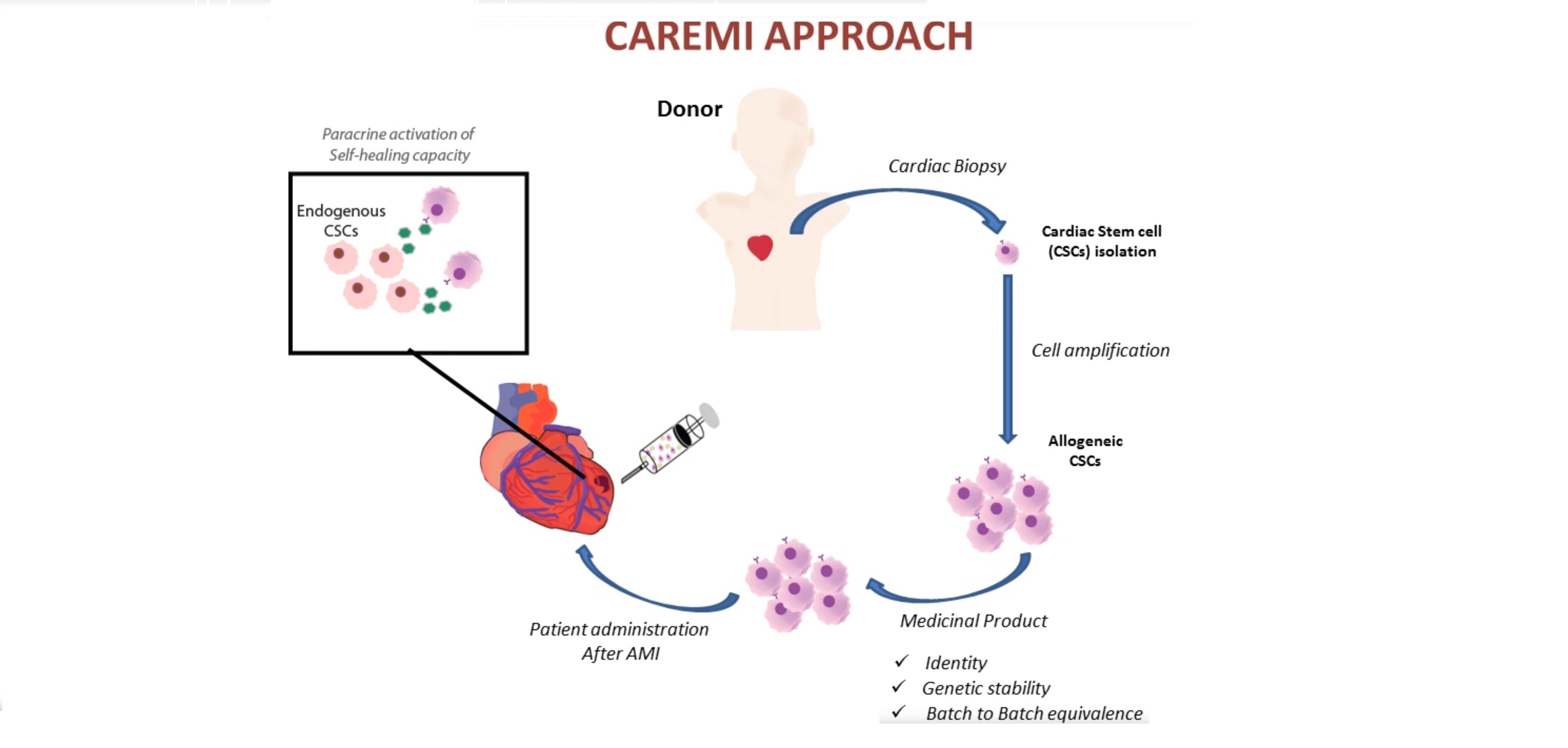 CAREMI concluye que las células madre donadas son una opción viable y segura tras un infarto