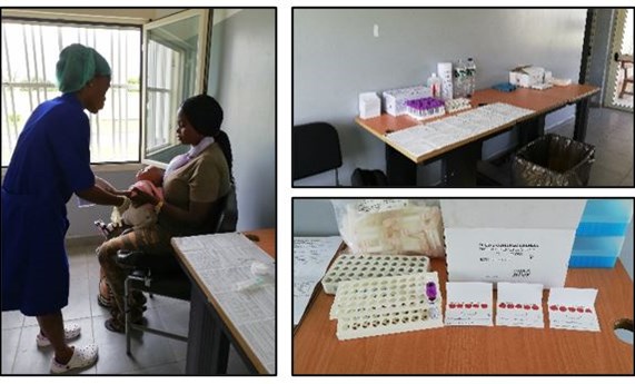 Investigadoras del CIBERESP estudian la resistencia a antirretrovirales del VIH en Guinea Ecuatorial