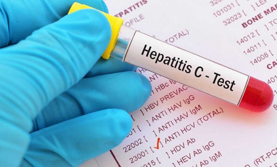 España, en la senda de eliminar la hepatitis C seis años antes del horizonte 2030 fijado por la OMS