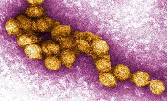 Describen el aumento de casos en España de la enfermedad del Virus del Nilo Occidental