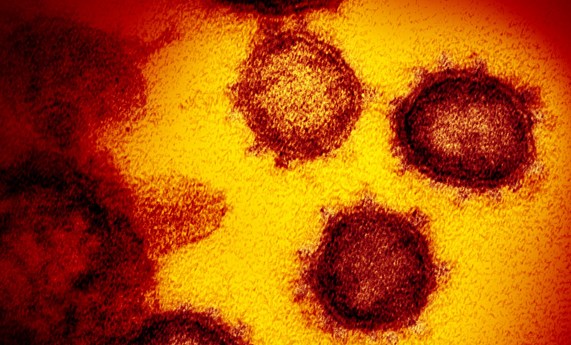 Una investigación revela que el 30% de infecciones por SARS-CoV-2 en la primera ola fueron asintomáticas