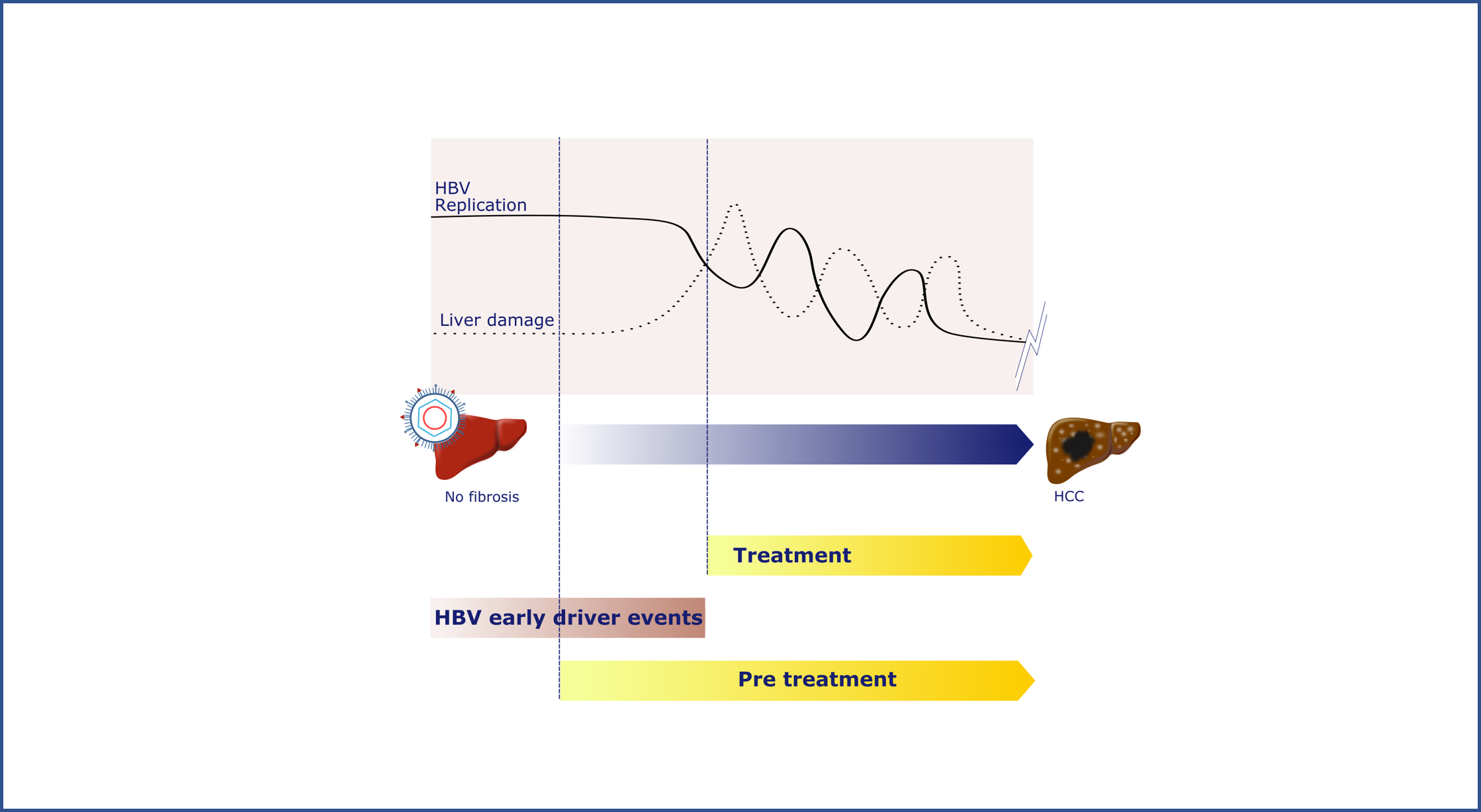 Desvelan datos genómicos que podrían ayudar a diagnosticar el cáncer hepático hasta dos décadas antes de que se manifieste