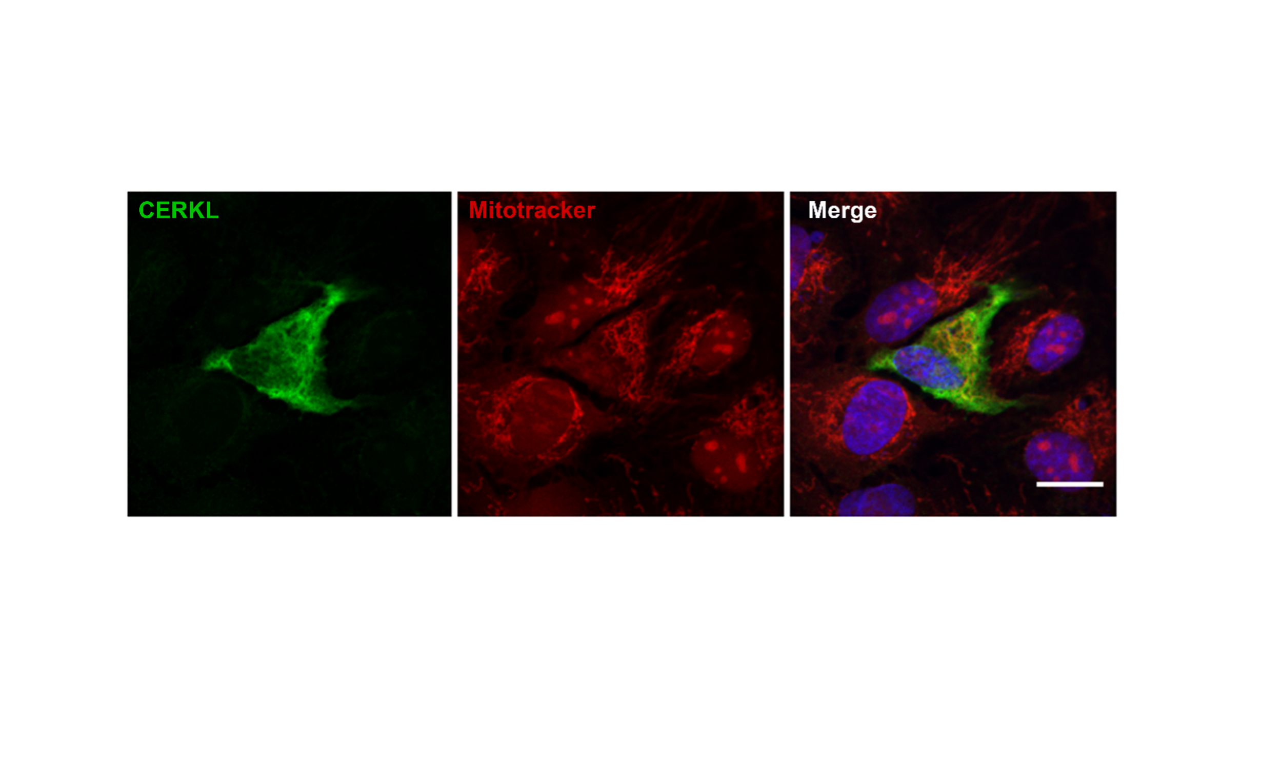 La sobreexpresión del gen causante de la retinosis pigmentaria ‘CERKL’ protege a las mitocondrias de la retina del estrés oxidativo