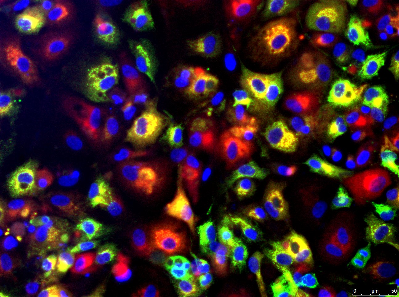 Aproximación innovadora para la terapia celular en enfermedades metabólicas hepáticas