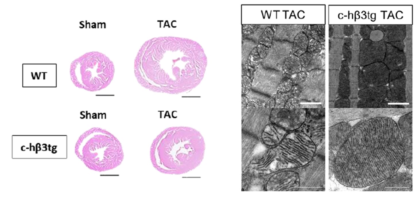 Identifican una nueva diana terapéutica capaz de prevenir la insuficiencia cardiaca asociada a estenosis aórtica
